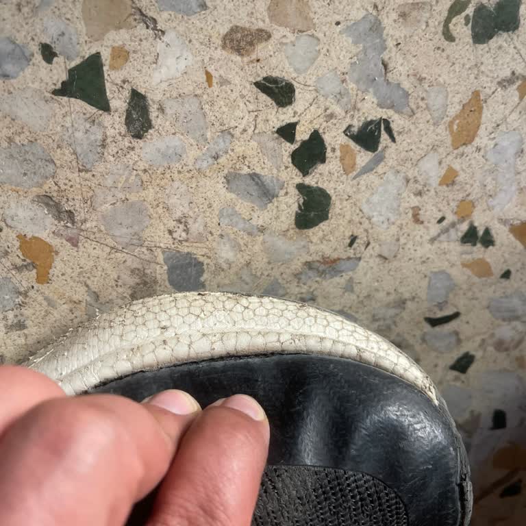 Ayakkabının Yapıştırma Yerlerinden Açılma Ve Kullanıcı Hatası Olarak Reddedilmesi