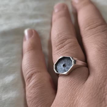 Yıldızlı Yüzükte Tekrar Eden Kalite Sorunu Ve Ücret İadesi Talebi