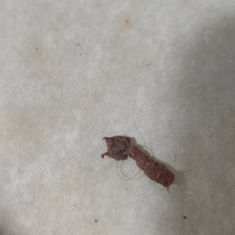 Kıl Çıkan Tavuk Ürünü Nedeniyle Hijyen Şikayetim Ve İade Talebim Reddedildi