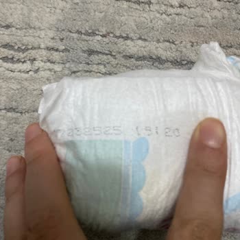 Şok Market’ten Satılan Tarihi Geçmiş Molfix Bebek Bezleri Nedeniyle Ciddi Pişik Şikayeti