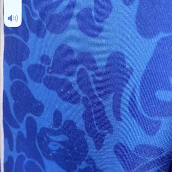 Üst Kısımda Tüylenme Ve İletişimsizlik Nedeniyle Ürün Değişimi Talebi