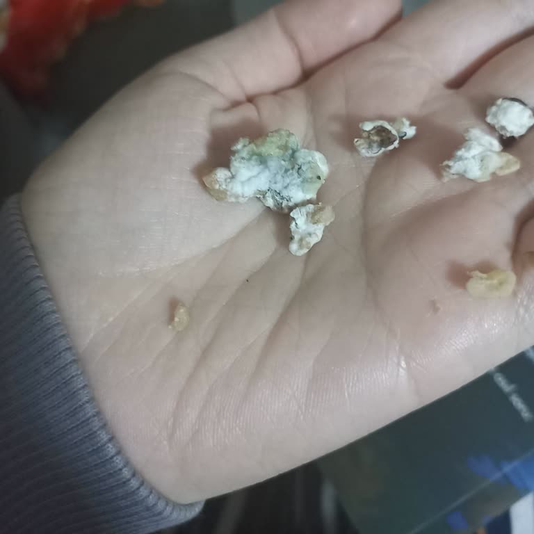 Küflü Ürün Ve Getir’in İade Reddi