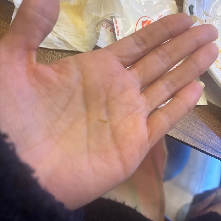 İftar Sofrasında Kirli Kaşık Ve Sivri Yabancı Madde: Hijyen Aksaklığına Şikayet