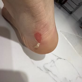 Boyner Ayakkabısı İlk Giyildiğinde Ayağa Vurdu, İade Talebim