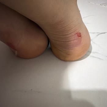 Boyner Ayakkabısı İlk Giyildiğinde Ayağa Vurdu, İade Talebim