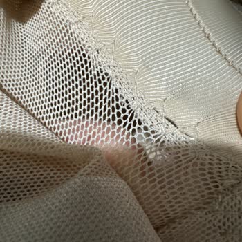 Korse Dikiş Hatası Ve İade Engeli Nedeniyle Para İadesi Talebi