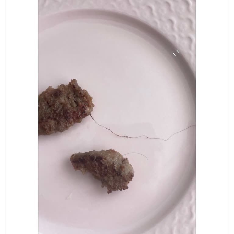 Köfte İçindeki Kıl Ve Cevapsız Müşteri Şikayeti