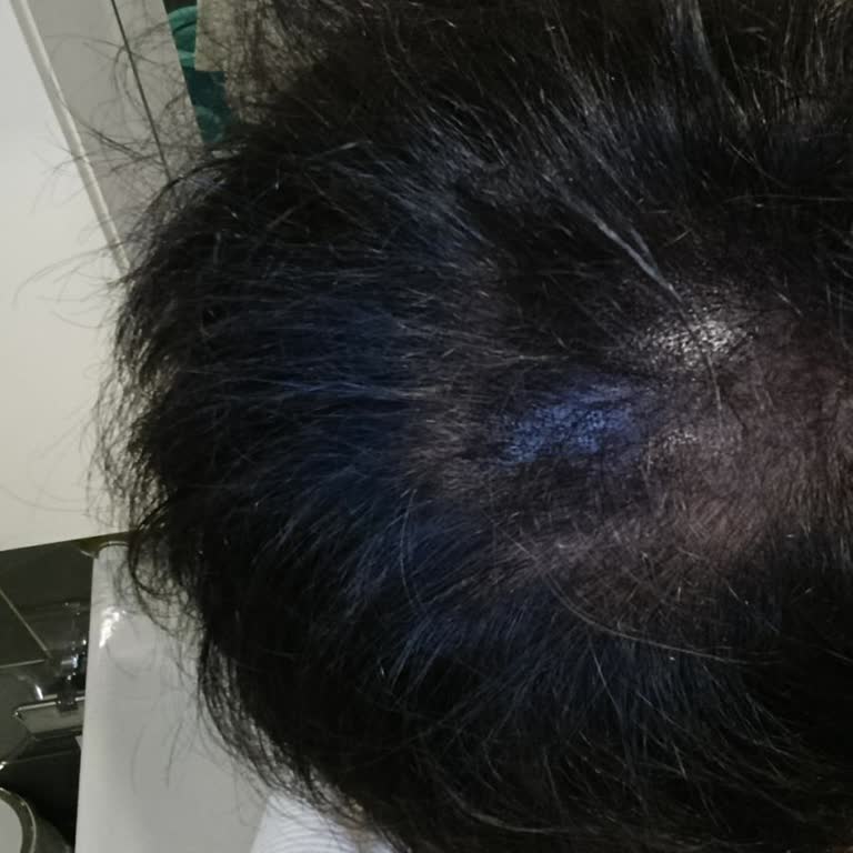 Saçım Maviye Döndü, Ürün Açıklamasıyla Çelişiyor Ve Ücret İadesi Talep Ediyorum