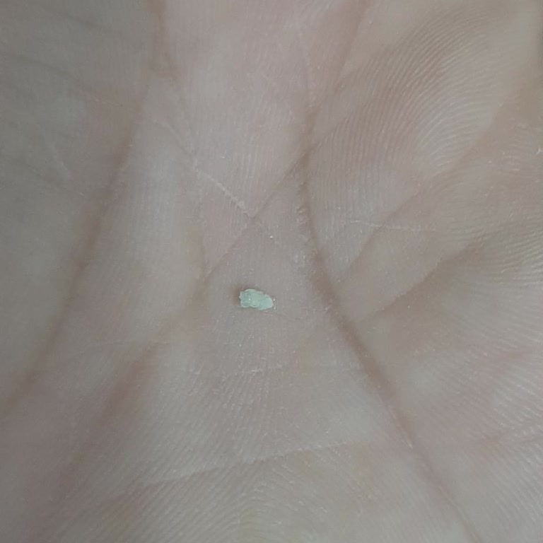 Harras Dana Salamında Kemik Parçası: Sağlık Riski