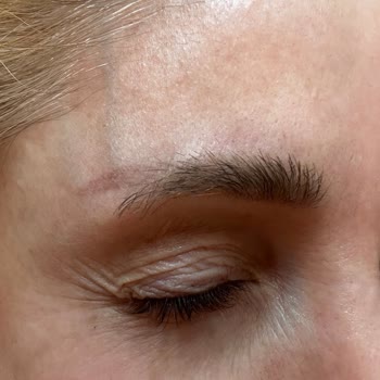 Yanıltıcı Sözler Ve Kaş Silme İşleminde Çirkin Sonuçlar