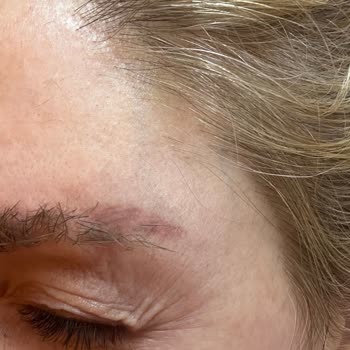 Yanıltıcı Sözler Ve Kaş Silme İşleminde Çirkin Sonuçlar