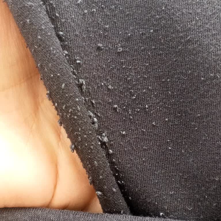 Eşofman Altındaki Tüylenme Sorunu Ve İade Talebi