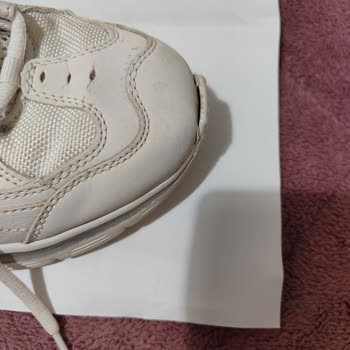 Skechers Ayakkabım Kısa Sürede Deforme Oldu, Boyner Değişim Talebimi Reddetti