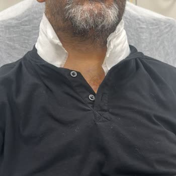 Boyun Bölgesine Aşırı Bası Ve Sevkin Gecikmesi Hastanın Durumunu Ağırlaştırdı