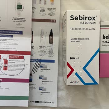 Saç Derisinde Kimyasal Yanık Ve Saç Dökülmesi Nedeniyle 5800 TL İadesi Talebi