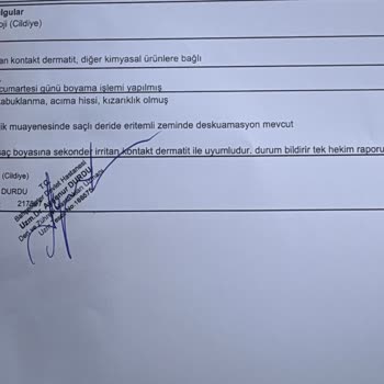 Saç Derisinde Kimyasal Yanık Ve Saç Dökülmesi Nedeniyle 5800 TL İadesi Talebi