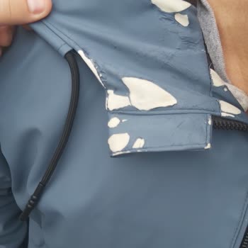 Zara Ceketinin Kısa Sürede Dökülerek Kullanılamaz Hale Gelmesi