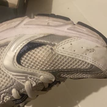 Deforme Ayakkabım Kullanıcı Hatası Olarak Reddedildi