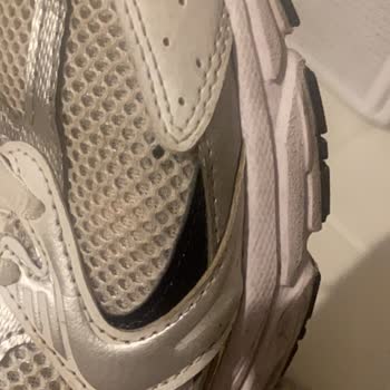 Deforme Ayakkabım Kullanıcı Hatası Olarak Reddedildi