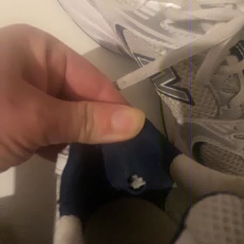 Deforme Ayakkabım Kullanıcı Hatası Olarak Reddedildi