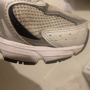 Deforme Ayakkabım Kullanıcı Hatası Olarak Reddedildi