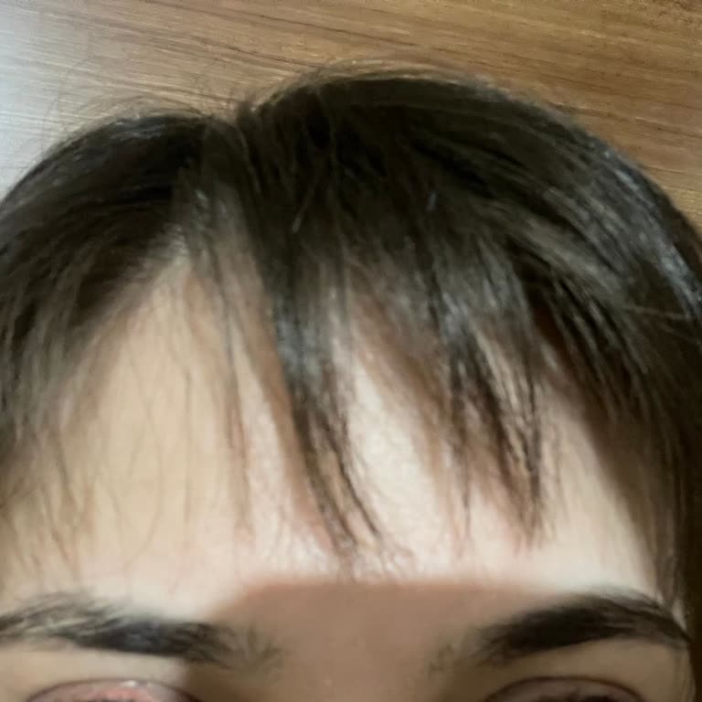 Kakülün Aşırı Kısalması Ve İşletme Sahibinin Saygısız Davranışı