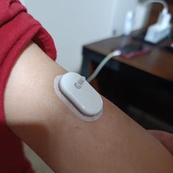 Dört Sensör Arızası Ve Yetersiz Müşteri Hizmeti