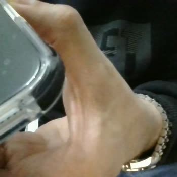 Mükemmel Olduğu Söylenen İphone 16’da Çizik Ve Mağdur Edici İade Süreci