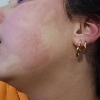 Sebamed Şampuanı Kızımda Yüz Kızarıklığına Neden Olduğu İçin İade İstiyorum