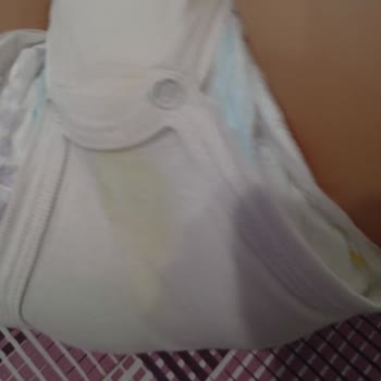 Molfix Bebek Bezinde Orta Kısım Taşması Ve Müşteri Hizmetinde Cevap Yok