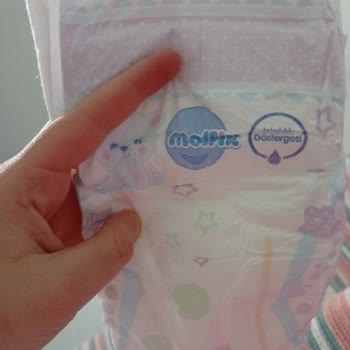 Molfix Bebek Bezinde Orta Kısım Taşması Ve Müşteri Hizmetinde Cevap Yok