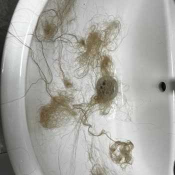 Kalitesiz Sentetik Saç Ve İade Talebi