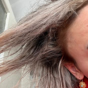 Ombre İşlemi Sonrası Saç Kopukluğu Ve Ücret İadesi Talebi