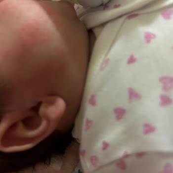 La Roche-Posay Lipikar Products Caused Burn-Like Reaction on Baby