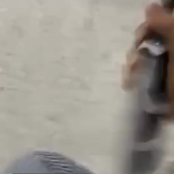 Morfose Saç Köpüğü Şikayeti!