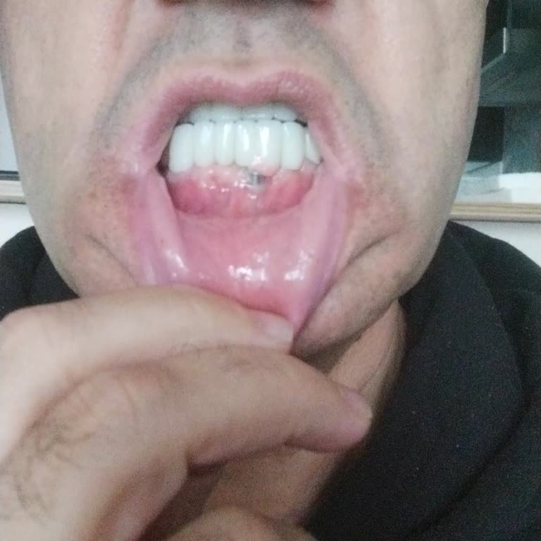 Şirinevler Dentbul Diş Kliniği Şikayeti