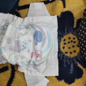 Molfix 5 Numaralı Bebek Bezinde Üretim Hatası Ve Değişim Talebi