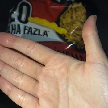 Migros Cips Paketi İçinde Saç Çıktı: Hijyen Ve Güvenlik Sorunu