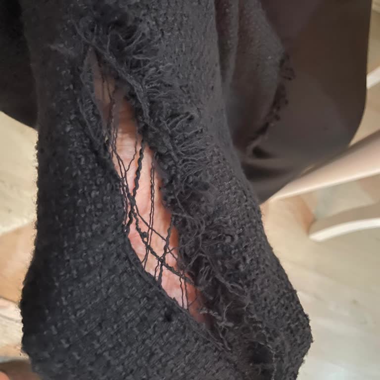 Üç Saatte Yırtılan Lüks Takım Ve Şirketin Kaba Davranışı