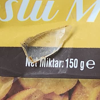 A101 Çerezya Mısırda Cam Parçası Yutuldu, Şiddetli Karın Ağrısı