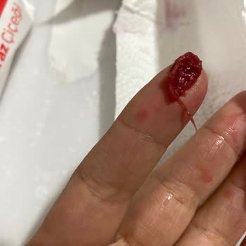 Dimes Vişne Suyunda Yabancı Madde Bulunması