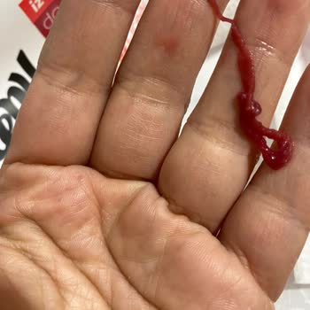 Dimes Vişne Suyunda Yabancı Madde Bulunması