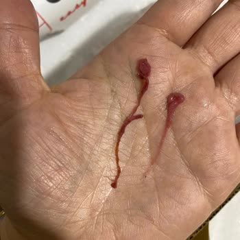 Dimes Vişne Suyunda Yabancı Madde Bulunması