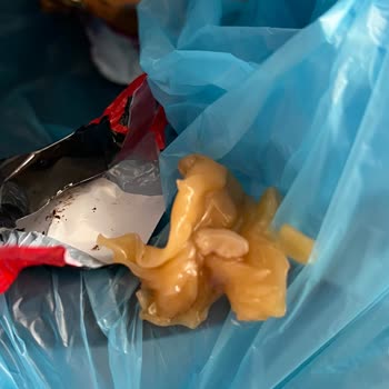 Konak Şekerin Sert Yapısı Diş Dolgusu Çıkararak Sağlık Ve Mahcubiyete Neden Oldu