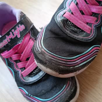 Boyner'de Skechers Ayakkabı Kısa Sürede Yıprandı, Garanti Talebi Reddedildi