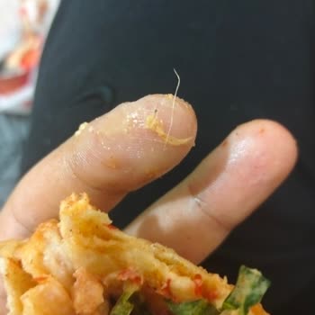 Tavuk Döner Dürümde Tüy Bulunması Hijyen Şikayeti