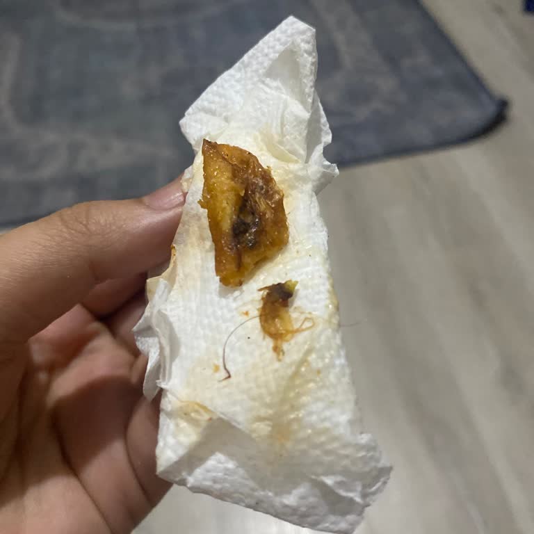 Hijyen İhlali: Tavuk Dürümdeki Kıl Ve Çöp, Getir Yemek Çözüm Sunmuyor