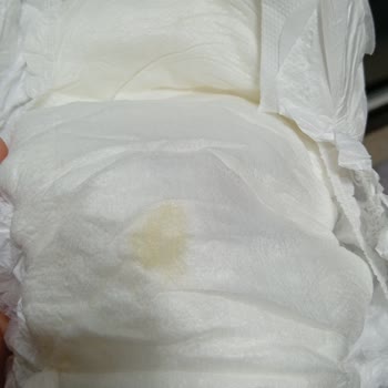 Açılmış Bebek Bezinde Sert Cisim Ve Lekeler: Güven Kaybı Ve Telafi Talebi