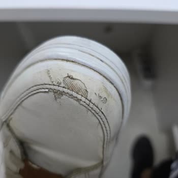 Ayakkabım 4 Ayda Deforme Oldu, Garanti Reddi Ve İade Talebi