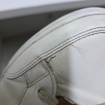 Ayakkabım 4 Ayda Deforme Oldu, Garanti Reddi Ve İade Talebi